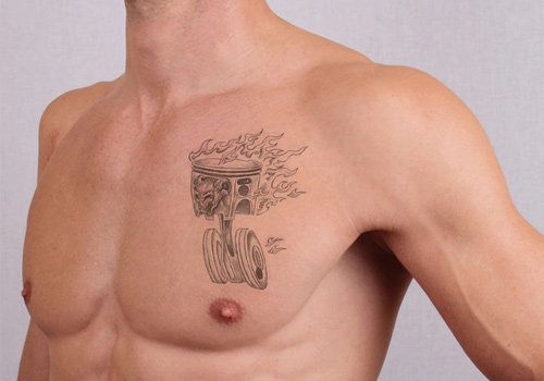 About - Dallas Tattoo Removal Clinic